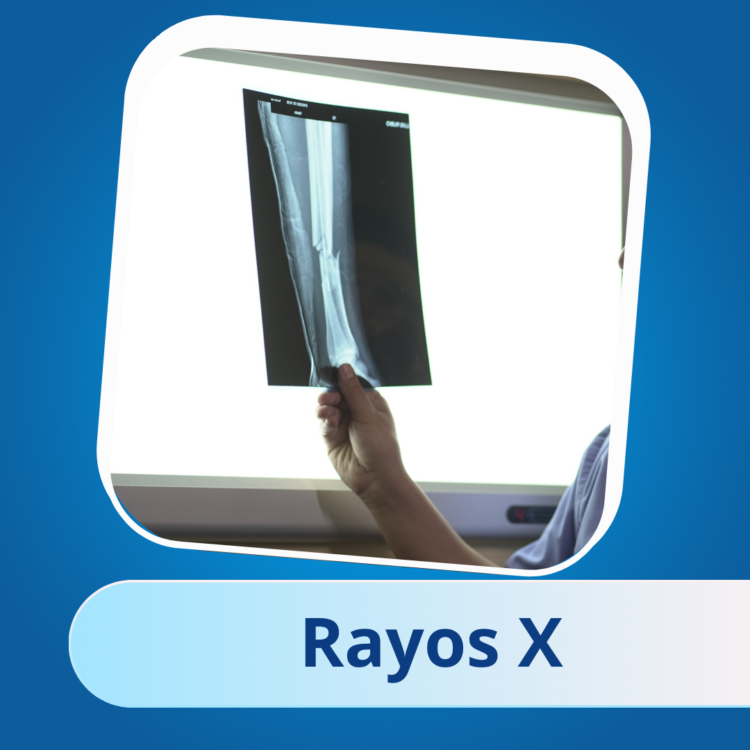 rayosX